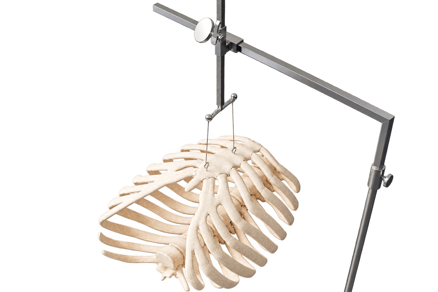 Easy Crane System: the next generation of pectus excavatum surgery